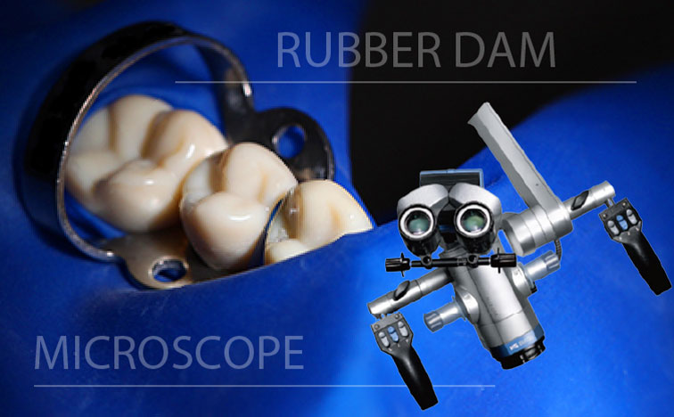 いつまでもご自身の歯を残すための 精密根管治療