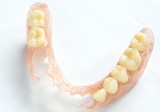 自由診療の入れ歯