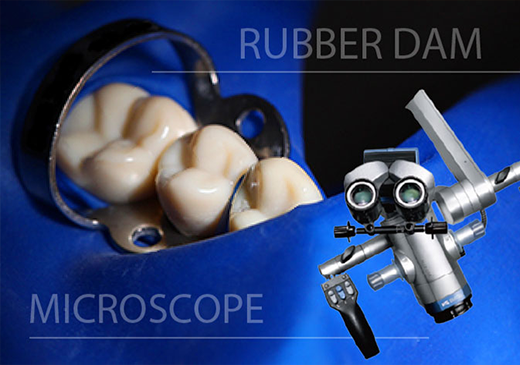 01歯を残すための「精密根管治療」